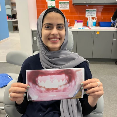 Adult Holding Braces Before & After Image